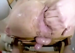 Prolapse Creampie