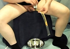 Fr22 catheter insertion