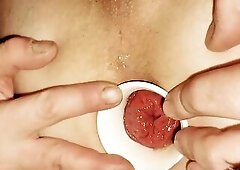 Reneenicolecd - update #24 - Interior view - prolapse - my gape naked - Mar thirty, 2026