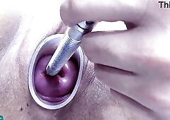 Lesbos pissing into the cervix of the other one directly since her pee gap