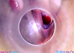 Melissa put camera unfathomable inside in her moist creamy vagina (Full HD twat web camera, endoscope)