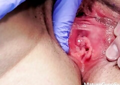 Our immoral gynecologist Tim Wetman shows u in detail the red pussy of chubby older woman Eveline Magic and takes her vaginal temperature