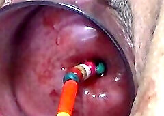 Uterus Penetration with Objects, Pumping Cervix Prolapse